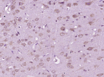 GRP78 Rabbit Polyclonal Antibody
