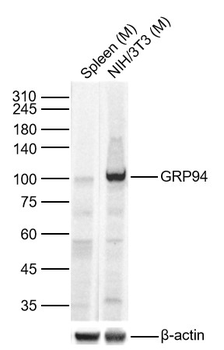GRP94 Rabbit Polyclonal Antibody