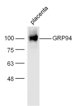 GRP94 Rabbit Polyclonal Antibody