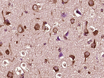 GRP94 Rabbit Polyclonal Antibody