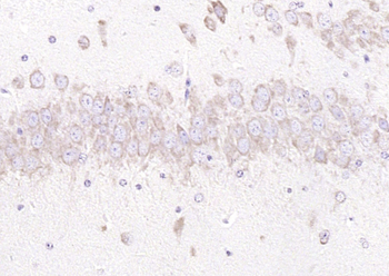 GRP94 Rabbit Polyclonal Antibody