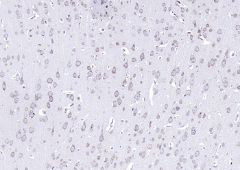 GRP94 Rabbit Polyclonal Antibody