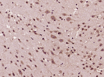 GSK-3 Beta Rabbit Polyclonal Antibody