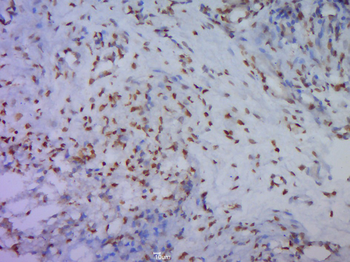 Phospho-GSK-3 Beta (Ser9) Rabbit Polyclonal Antibody