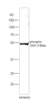 Phospho-GSK-3 Beta (Ser9) Rabbit Polyclonal Antibody