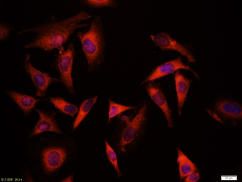 GSK-3 beta Mouse Polyclonal Antibody