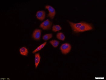 GSK-3 beta Mouse Polyclonal Antibody