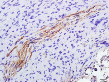 Glutathione Reductase Rabbit Polyclonal Antibody