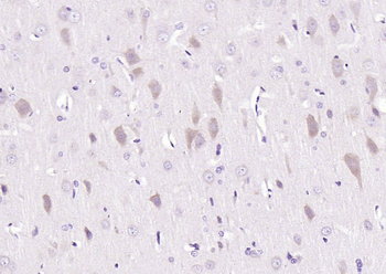 Glutathione Reductase Rabbit Polyclonal Antibody