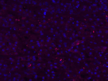 HBsAg Goat Polyclonal Antibody