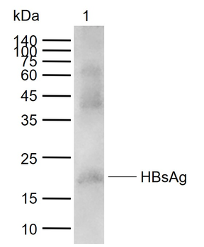 HBsAg Goat Polyclonal Antibody