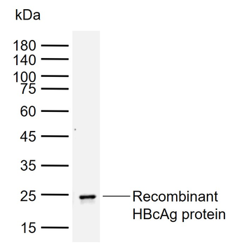 HBcAg Mouse Monoclonal Antibody