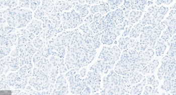 CGA Mouse Monoclonal Antibody