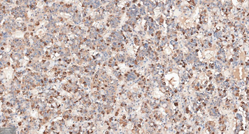 CGA Mouse Monoclonal Antibody