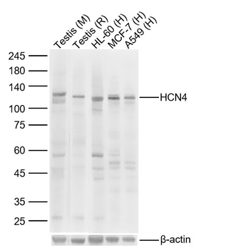 HCN4 Rabbit Polyclonal Antibody