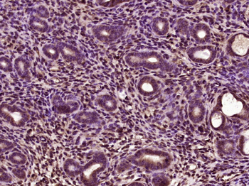 HIF1 beta Rabbit Polyclonal Antibody