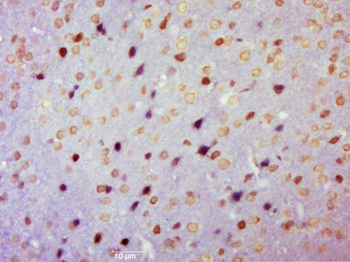 HIF 2 alpha Rabbit Polyclonal Antibody