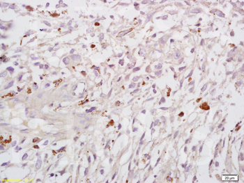 HIF 2 alpha Rabbit Polyclonal Antibody