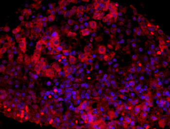 HIF 2 alpha Rabbit Polyclonal Antibody