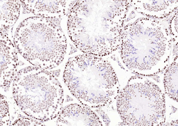 Histone H3 Rabbit Polyclonal Antibody (Nuclear Loading Control)
