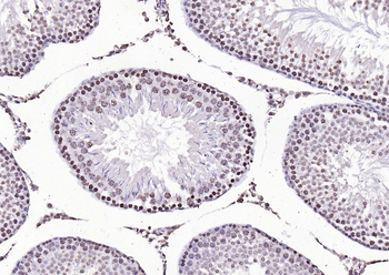 Histone H3 Rabbit Polyclonal Antibody (Nuclear Loading Control)