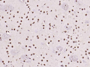 Histone H3 Rabbit Polyclonal Antibody (Nuclear Loading Control)