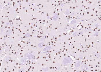 Histone H3 Rabbit Polyclonal Antibody (Nuclear Loading Control)