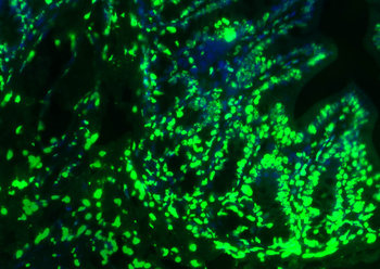 Histone H3 Rabbit Polyclonal Antibody (Nuclear Loading Control)