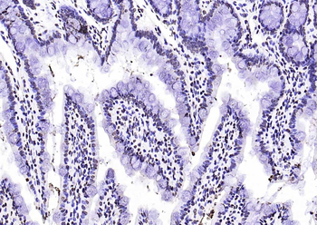 Histone H3 Rabbit Polyclonal Antibody (Nuclear Loading Control)