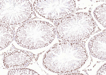 Histone H3 Rabbit Polyclonal Antibody (Nuclear Loading Control)