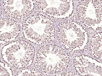 Histone H3 Rabbit Polyclonal Antibody (Nuclear Loading Control)