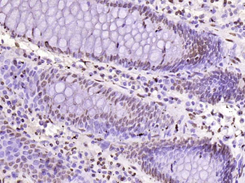 Histone H3 Rabbit Polyclonal Antibody (Nuclear Loading Control)