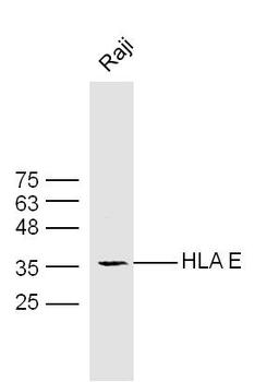 HLA E Rabbit Polyclonal Antibody
