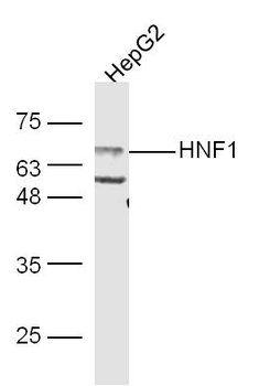 HNF1A Rabbit Polyclonal Antibody