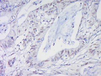 HOXc8 Rabbit Polyclonal Antibody