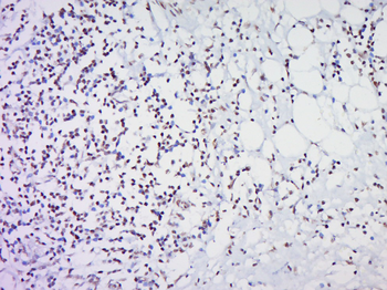 HOXc8 Rabbit Polyclonal Antibody