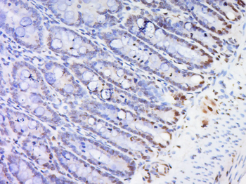 HOXc8 Rabbit Polyclonal Antibody