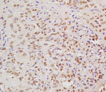 HPV16 E6 Rabbit Polyclonal Antibody