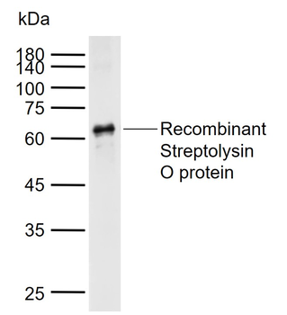 Streptolysin O Rabbit Polyclonal Antibody