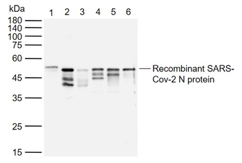 SARS-CoV-2 (2019-nCoV) Nucleocapsid Mouse Monoclonal Antibody