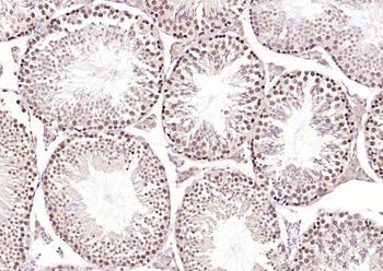 HSTF2 Rabbit Polyclonal Antibody