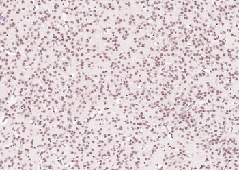 HSTF2 Rabbit Polyclonal Antibody