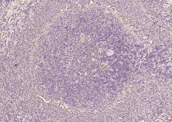 HSTF2 Rabbit Polyclonal Antibody