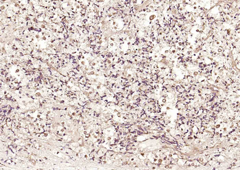 HSTF2 Rabbit Polyclonal Antibody