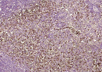 HSTF2 Rabbit Polyclonal Antibody