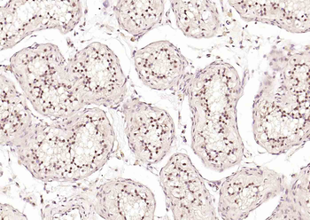 HSTF2 Rabbit Polyclonal Antibody