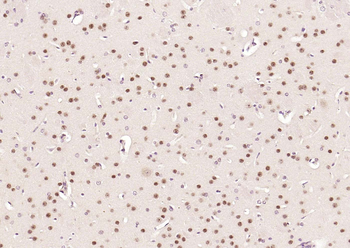 HSTF2 Rabbit Polyclonal Antibody