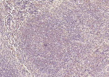 HSTF2 Rabbit Polyclonal Antibody