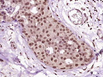 HSP27 Rabbit Polyclonal Antibody