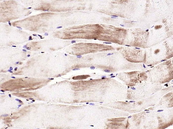 HSP27 Rabbit Polyclonal Antibody